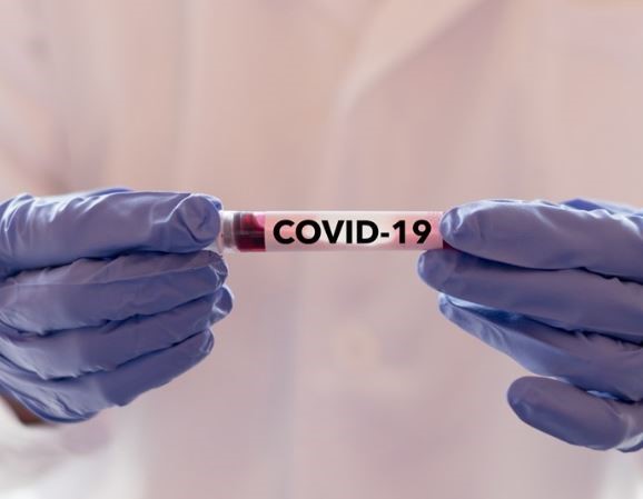 covid-19.JPG